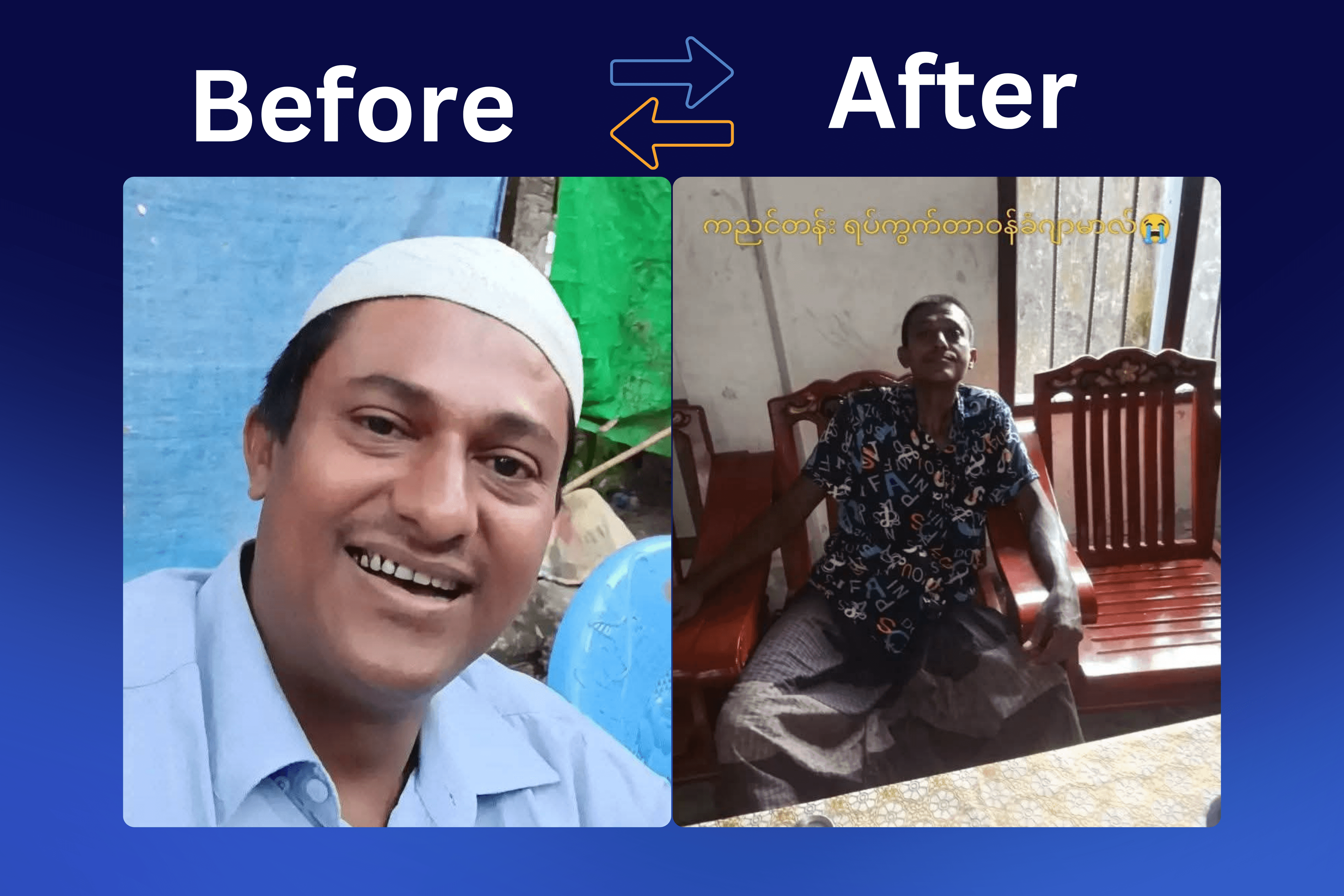 63 Prisoners Released from Buthidaung Prison Show Clear Signs of Brutal Torture by Arakan Army, Survivors Say